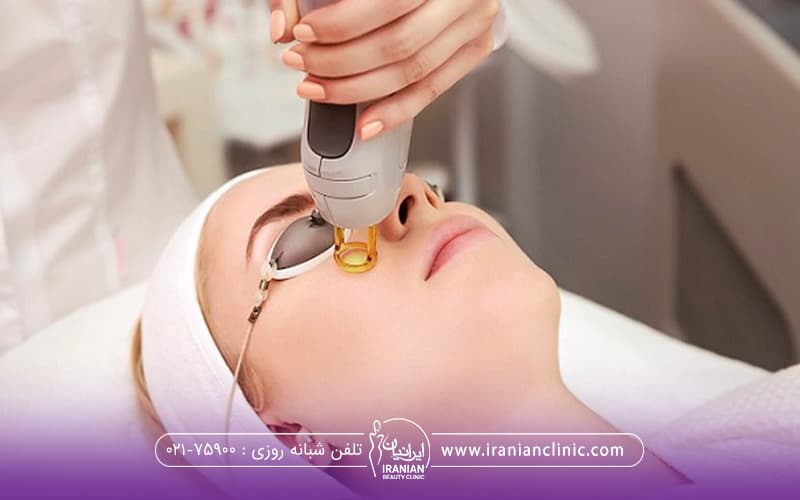 اپراتور لیزر که هندپیس را روی گونه دختر نگه داشته است - لیزر موهای زائد